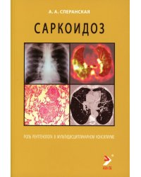 Саркоидоз. Роль ренгенолога в мультидисциплинарном консилиуме