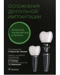 Осложнения дентальной имплантации. Этиология, профилактика и лечение