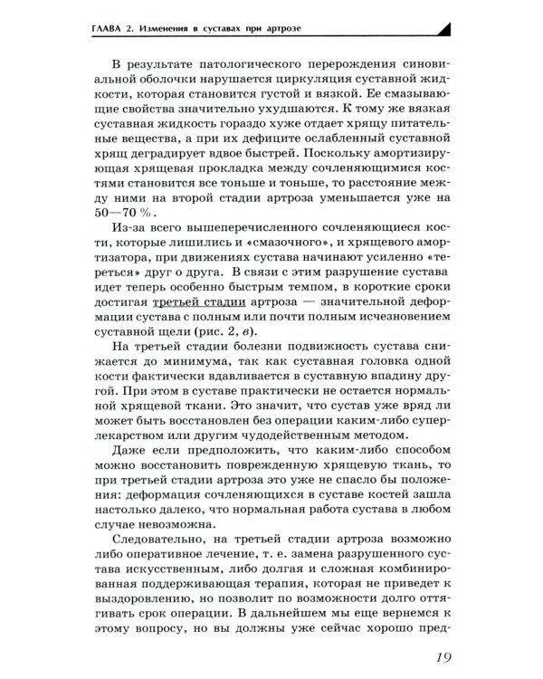 Артроз. Избавляемся от болей в суставах. 3-е изд., перераб