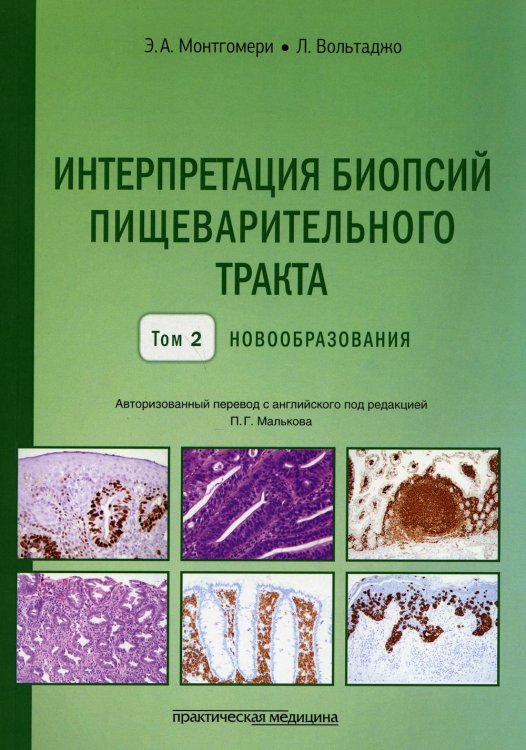 Интерпретация биопсий пищеварительного тракта. Т. 2: Новообразования