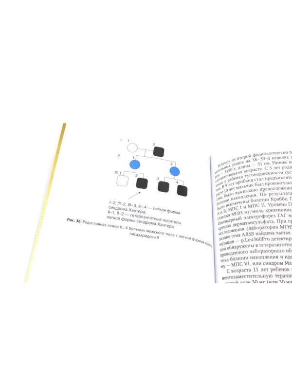 Мукополисахаридозы у детей: дифференциальная диагностика и лечение: Учебное пособие для врачей