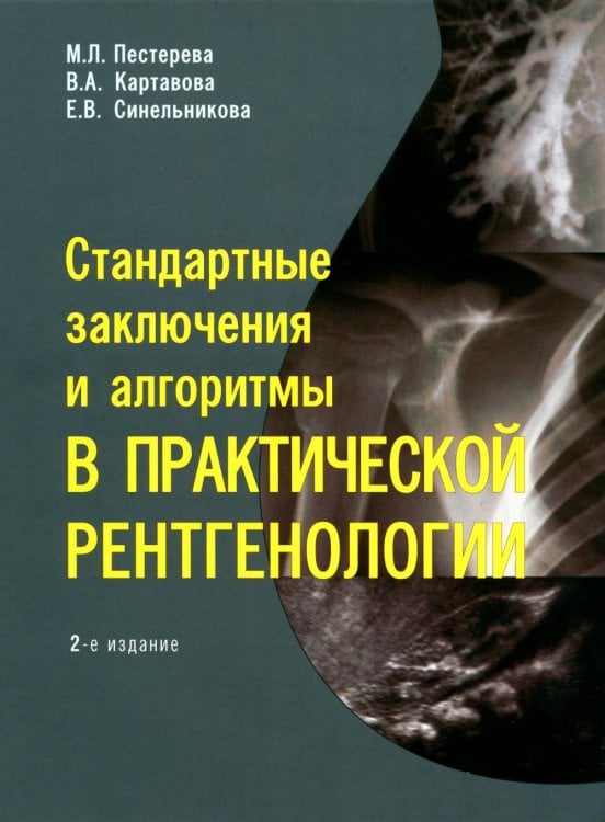 Стандартные заключения и алгоритмы в практической рентгенологии: Учебное пособие. 2-е изд