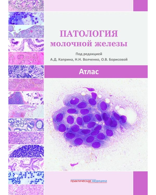 Патология молочной железы. Атлас