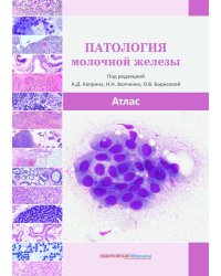 Патология молочной железы. Атлас