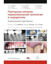 Повторное лечение периапикальной патологии в эндодонтии. Клинические протоколы