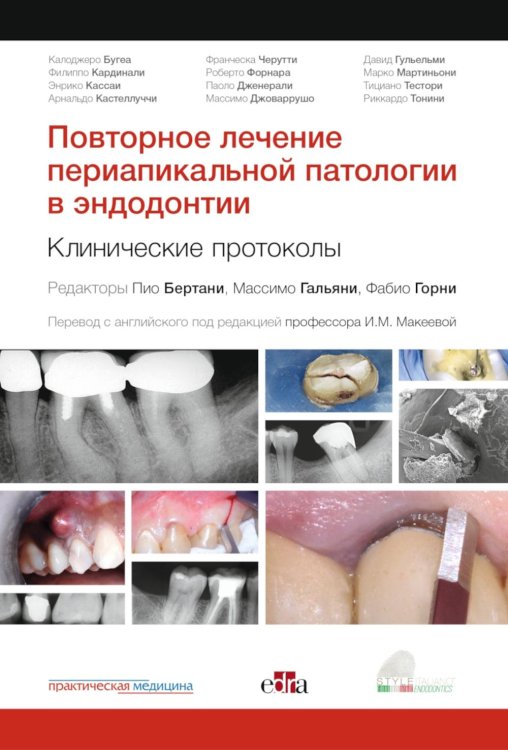 Повторное лечение периапикальной патологии в эндодонтии. Клинические протоколы