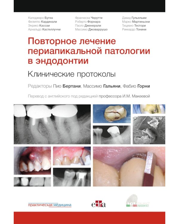 Повторное лечение периапикальной патологии в эндодонтии. Клинические протоколы