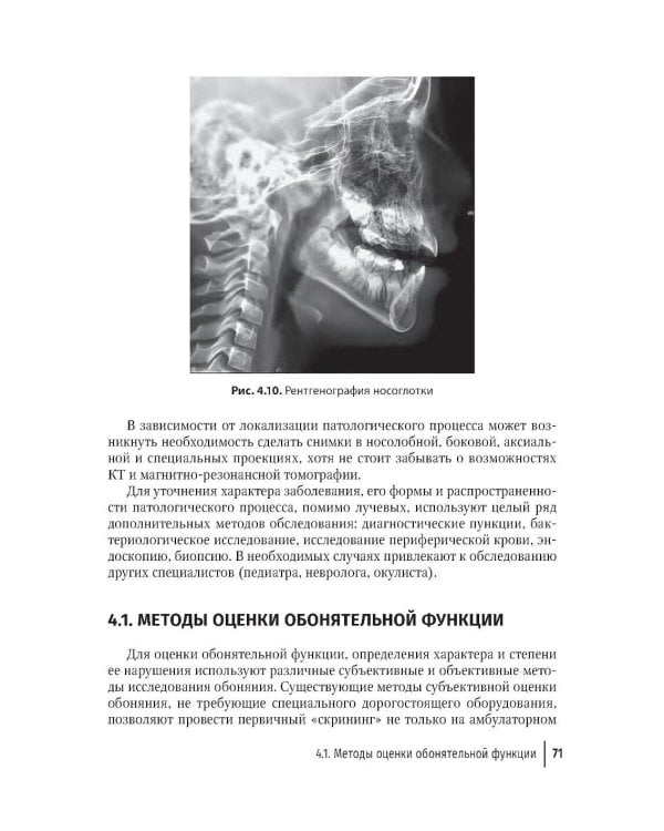 Ринит у детей: руководство для врачей