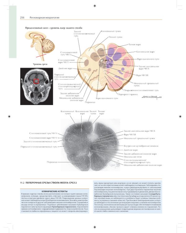 Неврология. Атлас с иллюстрациями Неттера