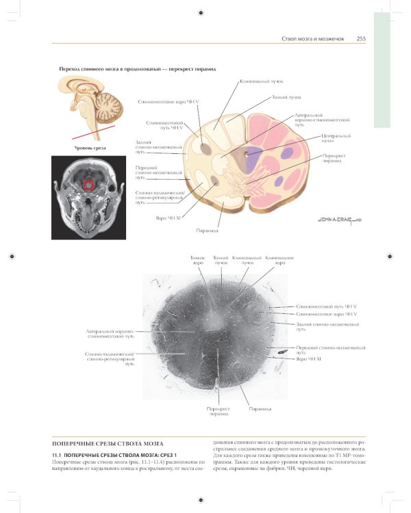 Неврология. Атлас с иллюстрациями Неттера