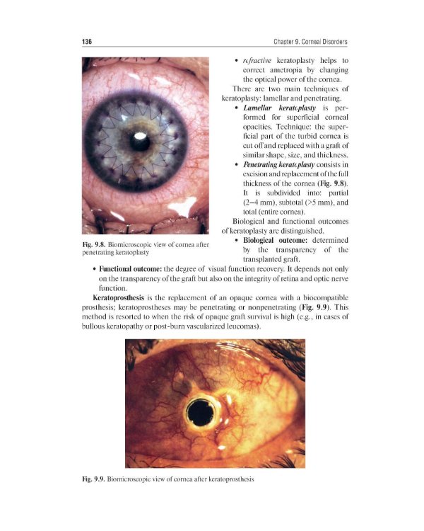 Ophthalmology = Офтальмология: textbook. 3-е изд., перераб. и доп.: на англ.яз