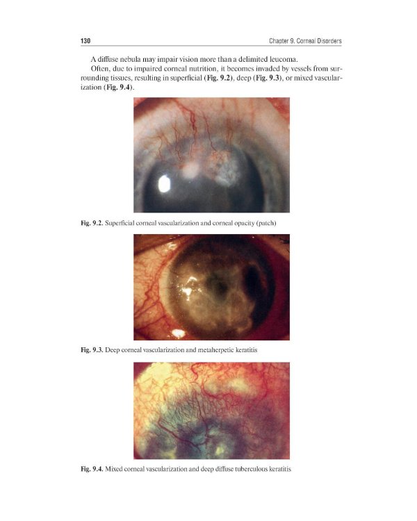 Ophthalmology = Офтальмология: textbook. 3-е изд., перераб. и доп.: на англ.яз