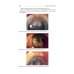 Ophthalmology = Офтальмология: textbook. 3-е изд., перераб. и доп.: на англ.яз