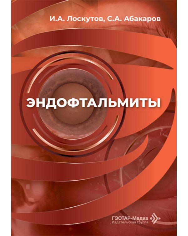 Эндофтальмиты: руководство для врачей