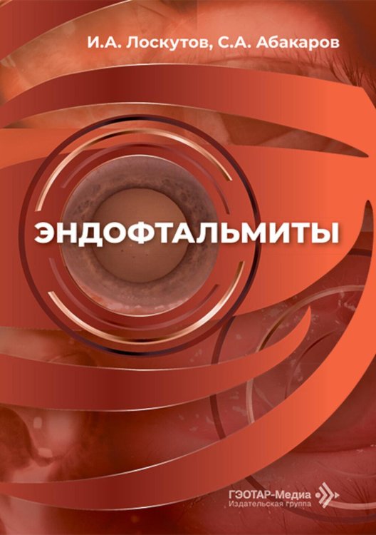 Эндофтальмиты: руководство для врачей
