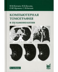 Компьютерная томография в пульмонологии. 4-е изд