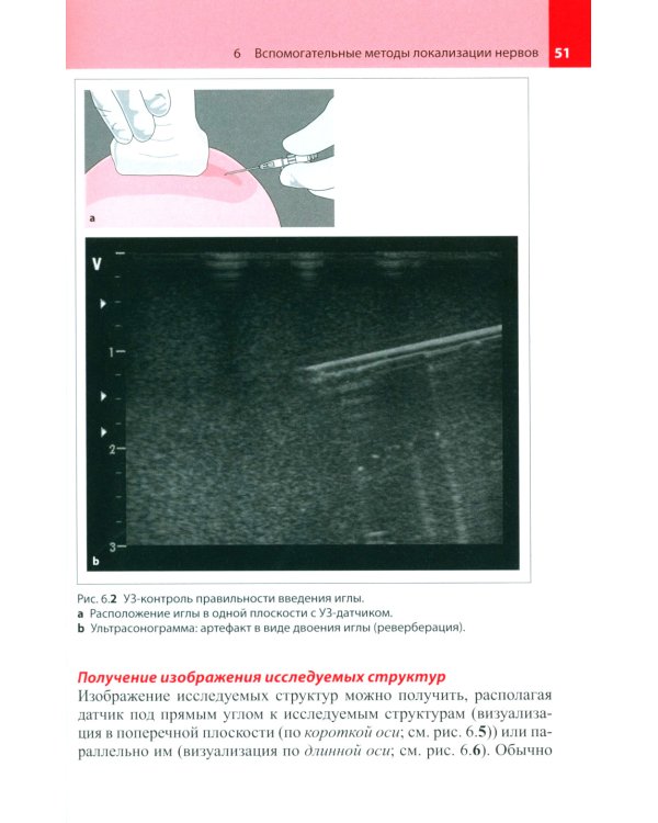 Блокады периферических нервов. 3-е изд