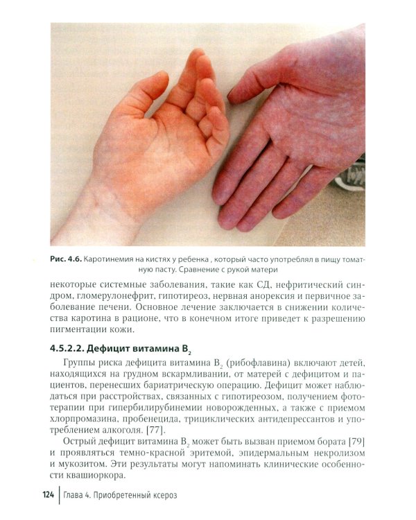 Физиология и патология кожи. Ксероз кожи