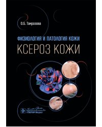 Физиология и патология кожи. Ксероз кожи