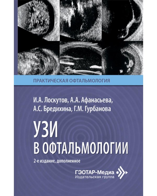 УЗИ в офтальмологии. 2-е изд., доп