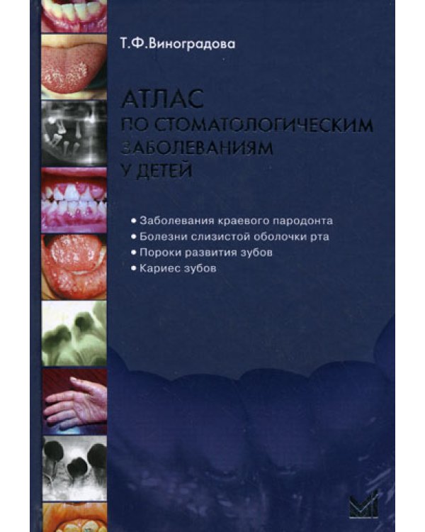 Атлас по стоматологическим заболеваниям у детей: учебное пособие. 2-е изд. + CD