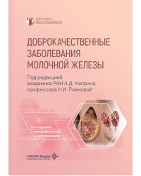 Доброкачественные заболевания молочной железы. 2-е изд., перераб. и доп