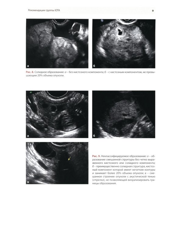 Стандартизация ультразвукового исследования патологии придатков матки по IOTA, O-RADS. Методические рекомендации. 4-е изд