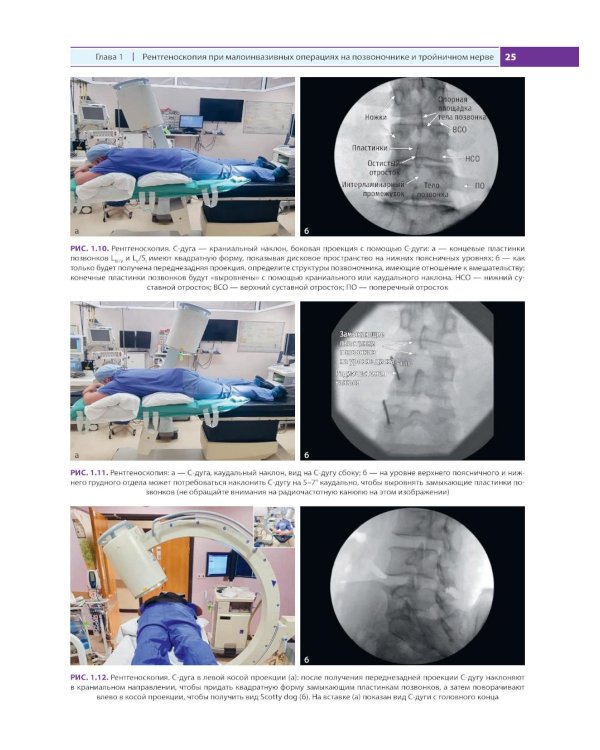 Дополнительное изображение книги «Интервенционная терапия боли. Практическое руководство и видеоатлас»