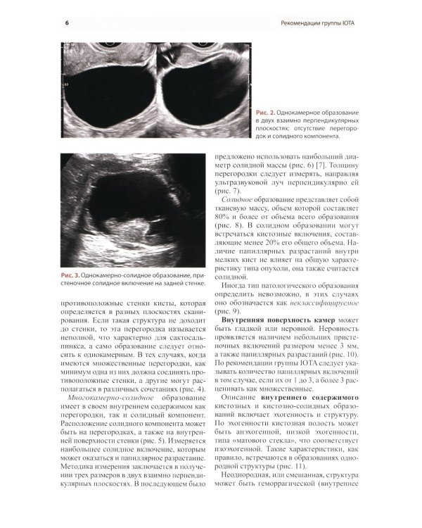 Стандартизация ультразвукового исследования патологии придатков матки по IOTA, O-RADS. Методические рекомендации. 4-е изд