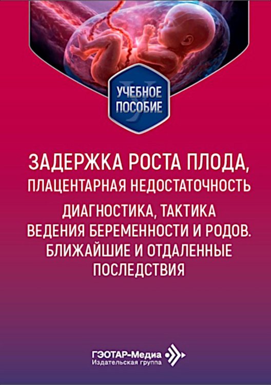 Обложка книги «Задержка роста плода, плацентарная недостаточность. Диагностика, тактика ведения беременности и родов. Ближайшие и отдаленные последствия» — Ильенко Лидия Ивановна;Сичинава Лали Григорьевна;Курцер Марк Аркадьевич, ISBN 9785002820023
