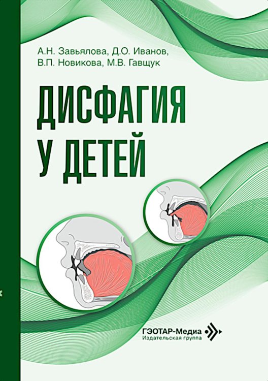 Обложка книги «Дисфагия у детей» — Новикова Валерия Павловна;Иванов Дмитрий Олегович;Завьялова Анна Никитична, ISBN 9785002820122