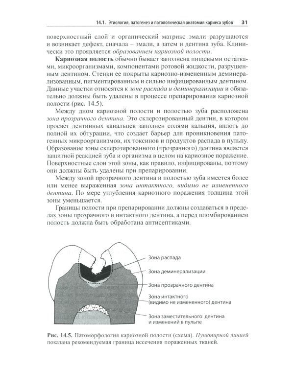 Практическая терапевтическая стоматология: Учебное пособие. В 3 т. Т. 2. 11-е изд