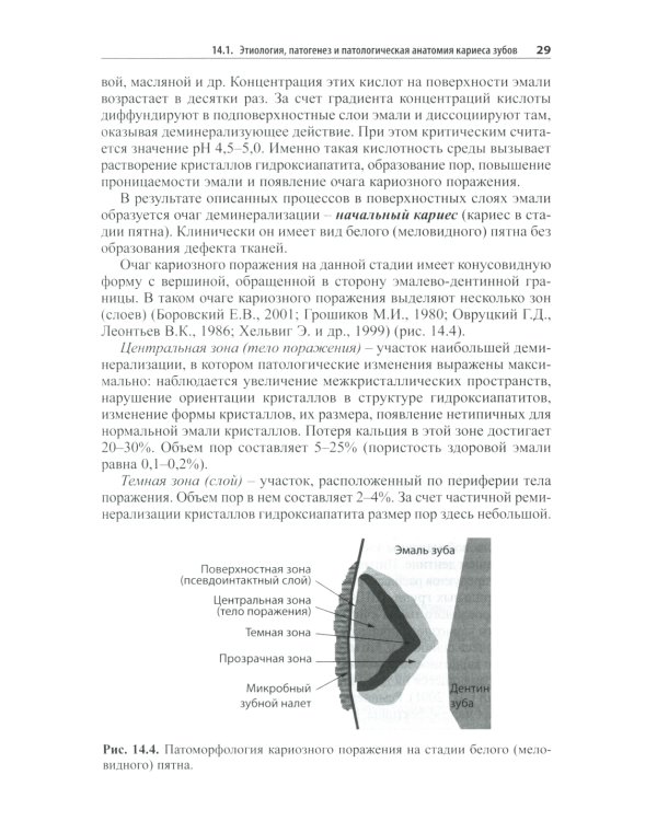 Практическая терапевтическая стоматология: Учебное пособие. В 3 т. Т. 2. 11-е изд