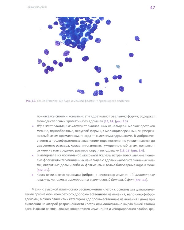 Йокогамская система интерпретации результатов тонкоигольной аспирационной биопсии молочной железы