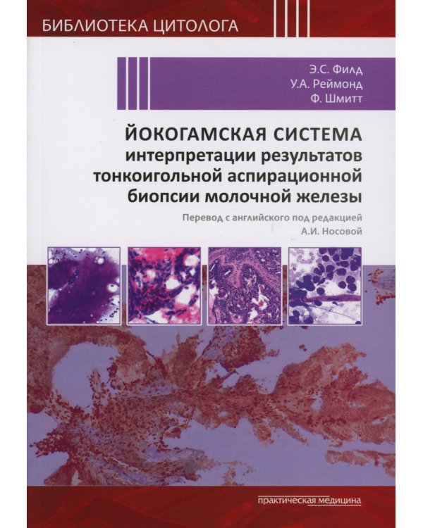 Йокогамская система интерпретации результатов тонкоигольной аспирационной биопсии молочной железы