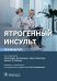 Ятрогенный инсульт: руководство для врачей