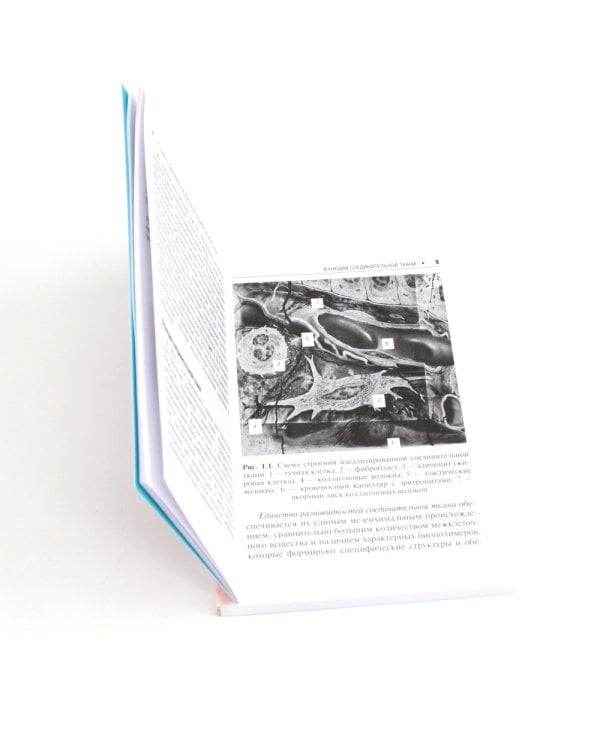 Дисплазия соединительной ткани. 2-е изд., испр. и доп