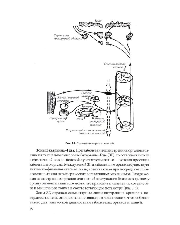 Физическая терапия в неврологии