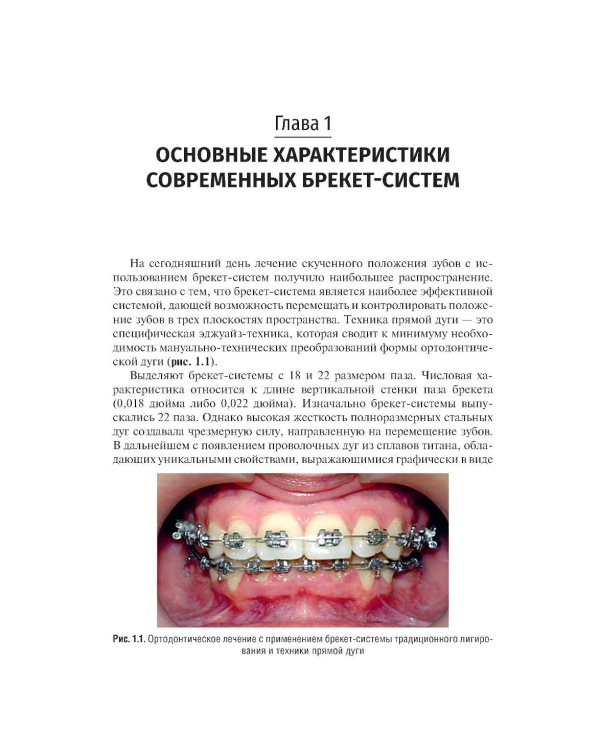 Дополнительное изображение книги «Ошибки фиксации брекет-систем и методы их устранения: Учебное пособие. 2-е изд., перераб»