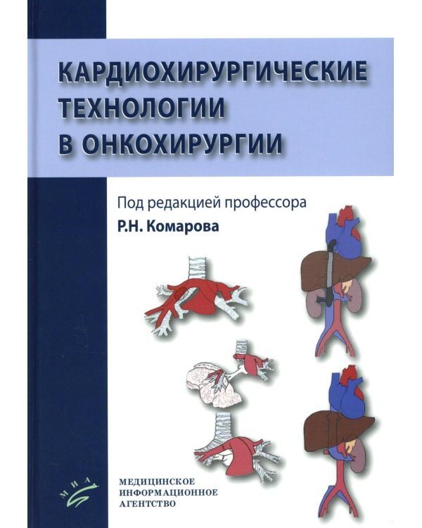 Кардиохирургические технологии в онкохирургии