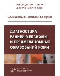 Диагностика ранней меланомы и предмеланомных образований кожи: Руководство - атлас для врачей первичного звена