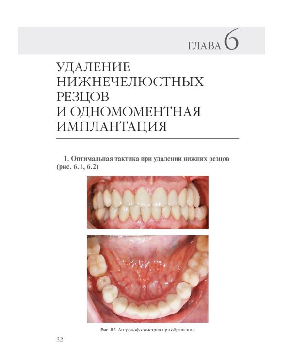 Дополнительное изображение книги «Принципы костной пластики в дентальной имплантации»