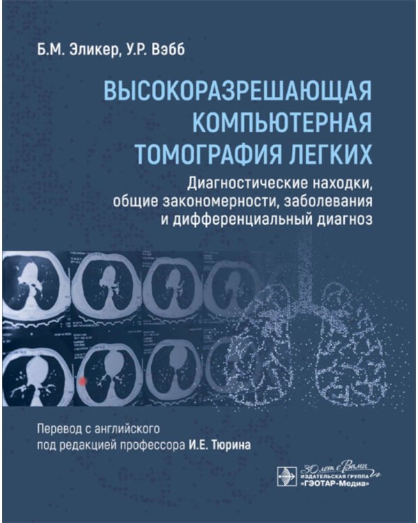 Высокоразрешающая компьютерная томография легких. Диагностические находки, общие закономерности, заболевания и дифференциальный диагноз