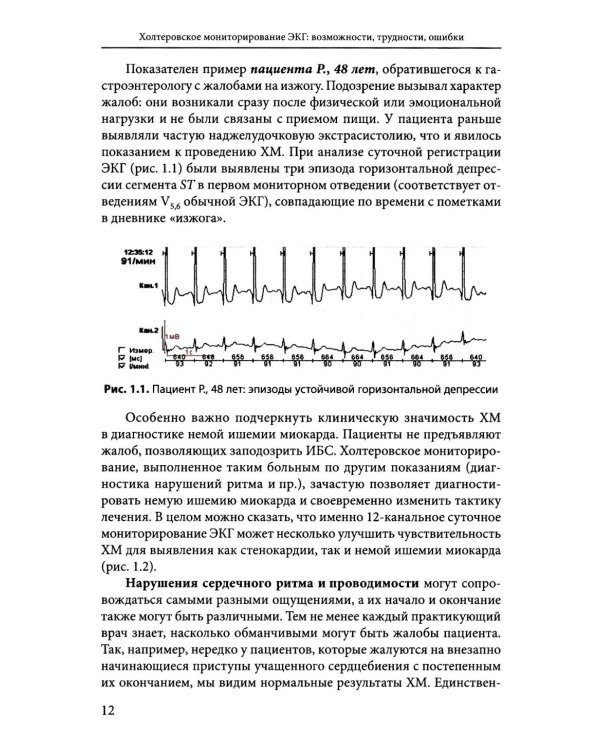 Холтеровское мониторирование ЭКГ: возможности, трудности, ошибки. 5-е изд., испр.и доп