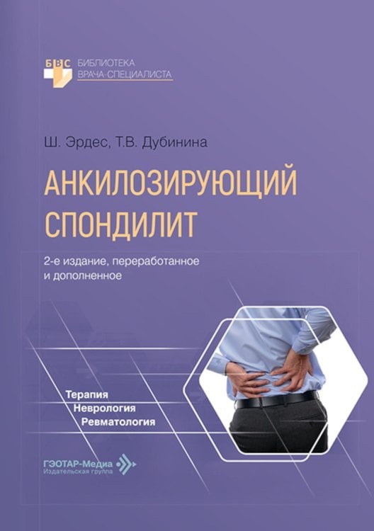 Обложка книги «Анкилозирующий спондилит. 2-е изд., перераб. и доп» — Эрдес Шандор;Дубинина Татьяна Васильевна, ISBN 9785970498873