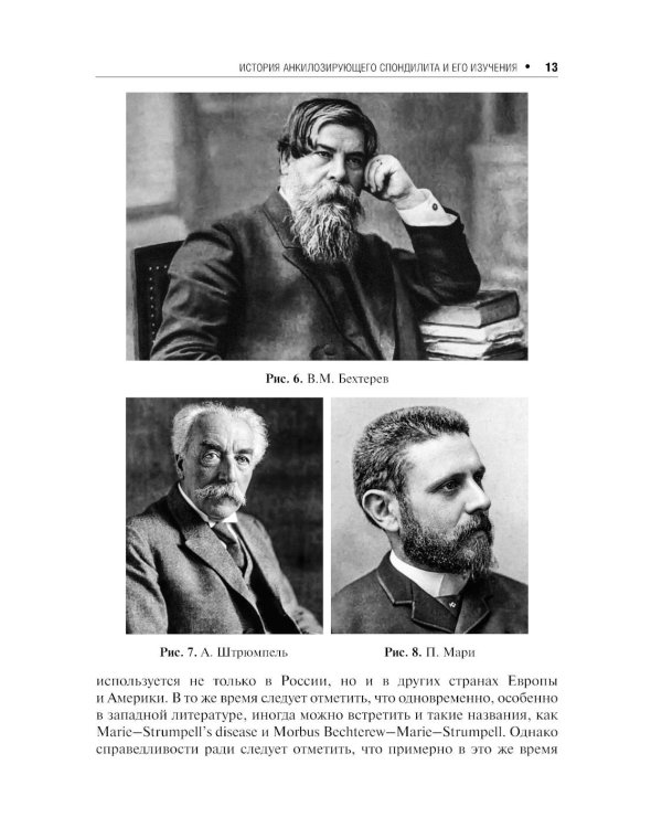 Дополнительное изображение книги «Анкилозирующий спондилит. 2-е изд., перераб. и доп»