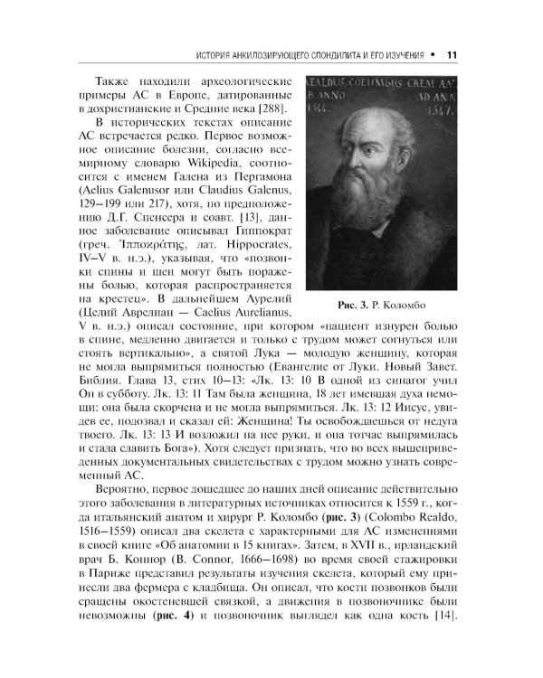 Дополнительное изображение книги «Анкилозирующий спондилит. 2-е изд., перераб. и доп»
