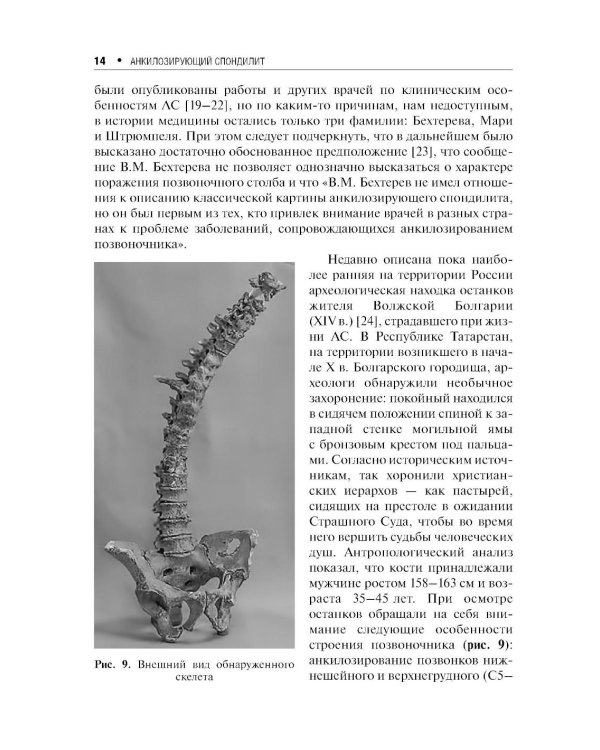 Дополнительное изображение книги «Анкилозирующий спондилит. 2-е изд., перераб. и доп»