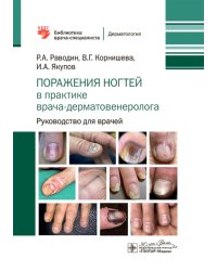 Поражения ногтей в практике врача-дерматовенеролога: руководство для врачей