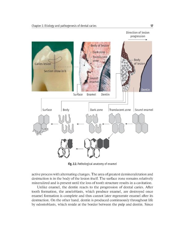 Дополнительное изображение книги «Preclinical course of dentistry: textbook : in 5 parts. Part II. Cariesology and direct restoration. (книга на англ. яз)»